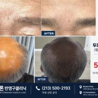 부자연스러운 눈썹과 가발과는 이제 작별하세요: 9월의 특별한 초대